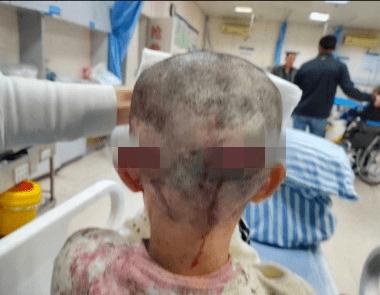 安徽7岁女童家门口被恶犬咬伤，家属称狗主人至今没赔偿，准备卖新车救女