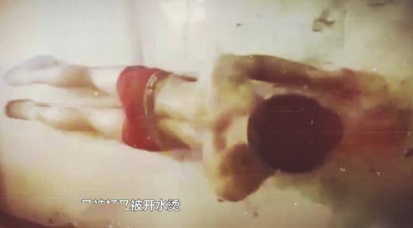 “又被打又被开水烫”！男子被骗缅北，移送回国后讲述生死遭遇