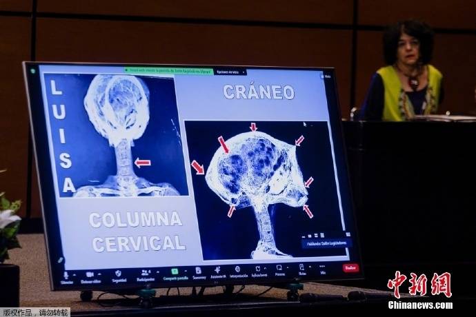 后续来了 墨西哥展示疑似外星人遗骸X光片