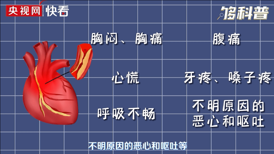 中国心梗救治日|敲黑板，这些关于心梗的重点知识要掌握！